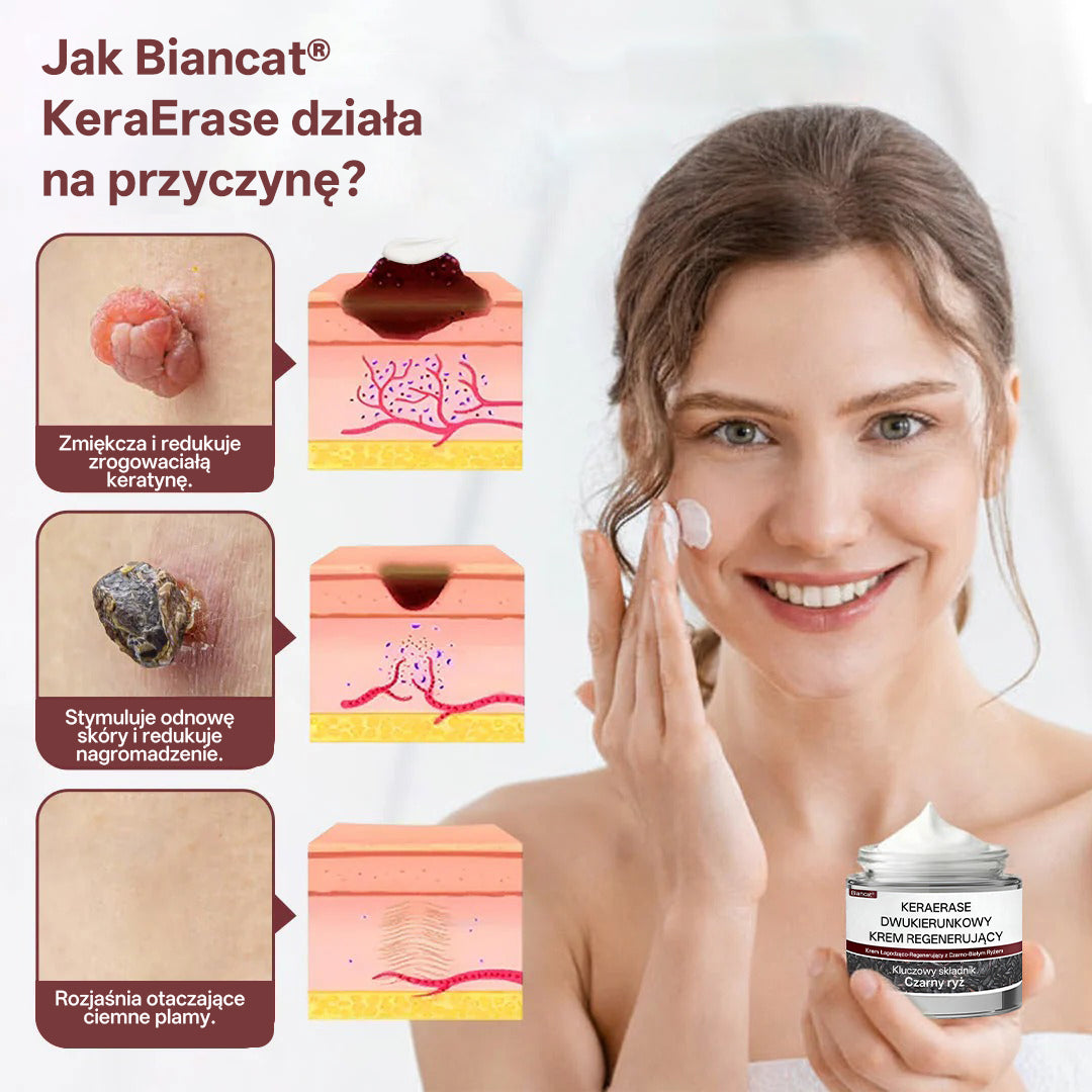 🌟 Biancat® KeraErase Dwukierunkowy Krem Regenerujący 👨‍⚕️ (do leczenia brodawek, narośli skórnych, plam oraz hiperpigmentacji)