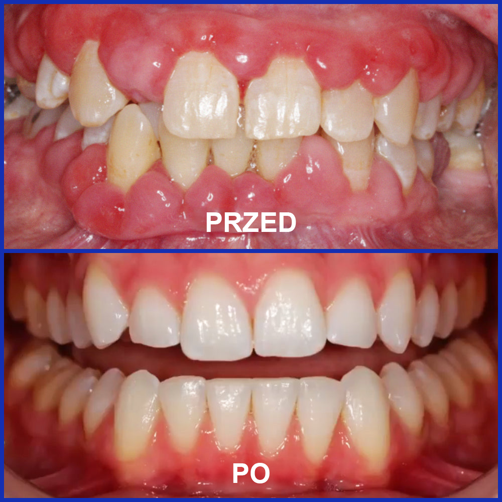 🌟Rolimey® VioCore Pasta do Zębów z Jadłem Pszczelim do Leczenia Dentystycznego