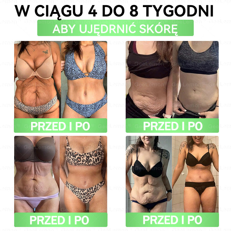 ⭐Oficjalny Sklep | 🇵🇱 𝐆𝐞𝐞𝐥𝐞𝐦𝐨𝐧® Glumasetide 8 w 1 Smukły i Zdrowy Nano Plaster z Mikronakłuciami ✅ Na otyłość, wiotką skórę, cukrzycę, bezdech senny, problemy ze stawami i wiele więcej