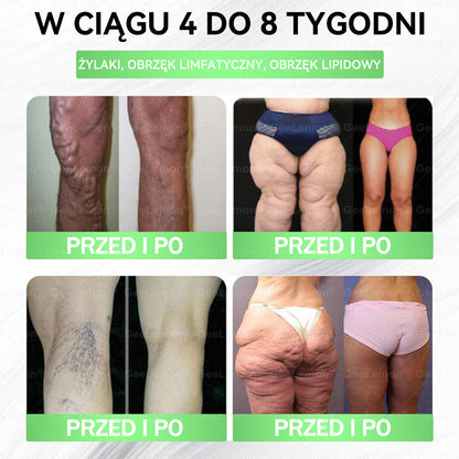⭐Oficjalny Sklep | 🇵🇱 𝐆𝐞𝐞𝐥𝐞𝐦𝐨𝐧® Glumasetide 8 w 1 Smukły i Zdrowy Nano Plaster z Mikronakłuciami ✅ Na otyłość, wiotką skórę, cukrzycę, bezdech senny, problemy ze stawami i wiele więcej