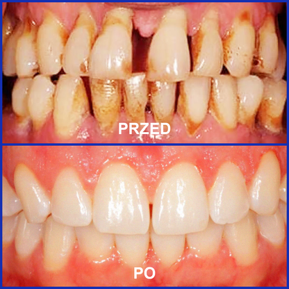 🌟Rolimey® VioCore Pasta do Zębów z Jadłem Pszczelim do Leczenia Dentystycznego