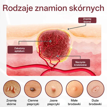 🌟 Biancat® KeraErase Dwukierunkowy Krem Regenerujący 👨‍⚕️ (do leczenia brodawek, narośli skórnych, plam oraz hiperpigmentacji)