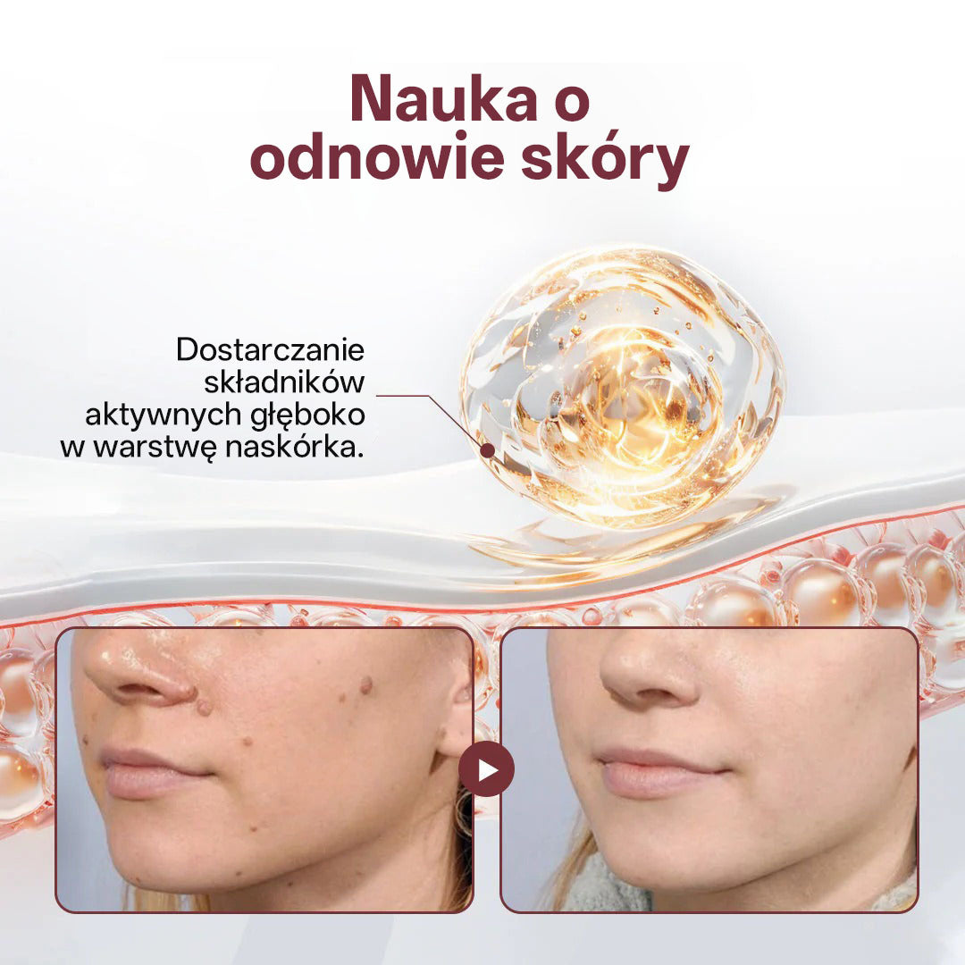 🌟 Biancat® KeraErase Dwukierunkowy Krem Regenerujący 👨‍⚕️ (do leczenia brodawek, narośli skórnych, plam oraz hiperpigmentacji)