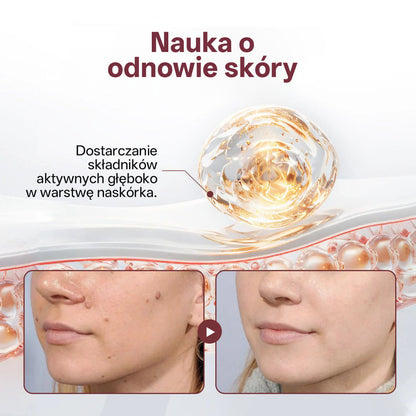 🌟 Biancat® KeraErase Dwukierunkowy Krem Regenerujący 👨‍⚕️ (do leczenia brodawek, narośli skórnych, plam oraz hiperpigmentacji)