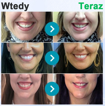 🌟Rolimey® VioCore Pasta do Zębów z Jadłem Pszczelim do Leczenia Dentystycznego