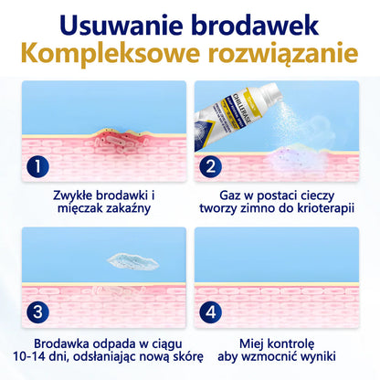 🎁 Timilk® ChillErase Spray odnawiający skórę