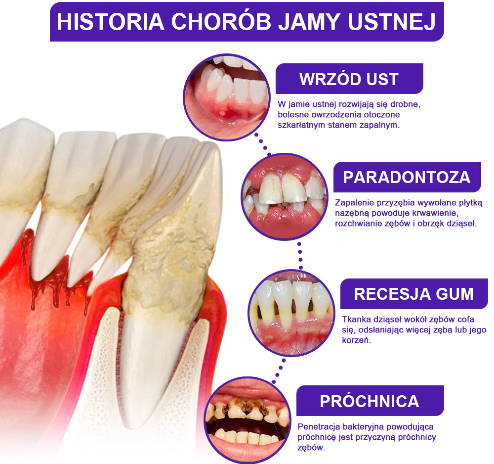 🌟Rolimey® VioCore Pasta do Zębów z Jadłem Pszczelim do Leczenia Dentystycznego
