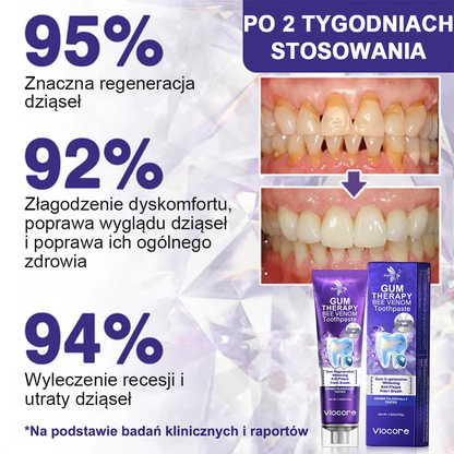 🌟Rolimey® VioCore Pasta do Zębów z Jadłem Pszczelim do Leczenia Dentystycznego